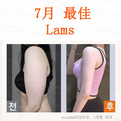 韩国365mc医院手臂lams吸脂对比图