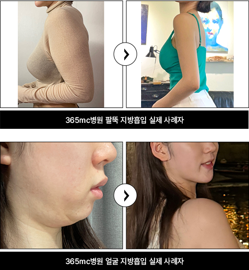 韩国365mc医院案例图