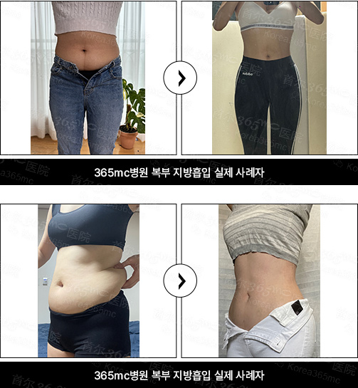 韩国365mc医院案例图