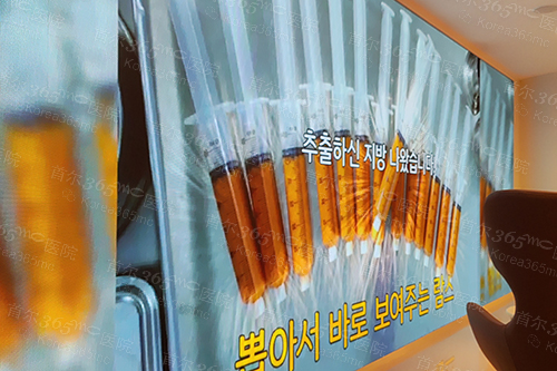 韩国365mc医院兰斯吸脂