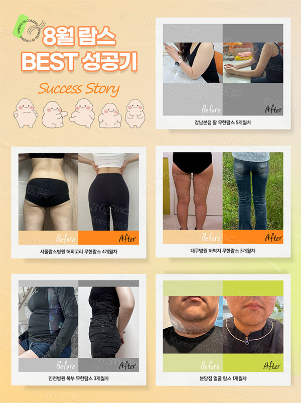 韩国365mc医院前后对比图