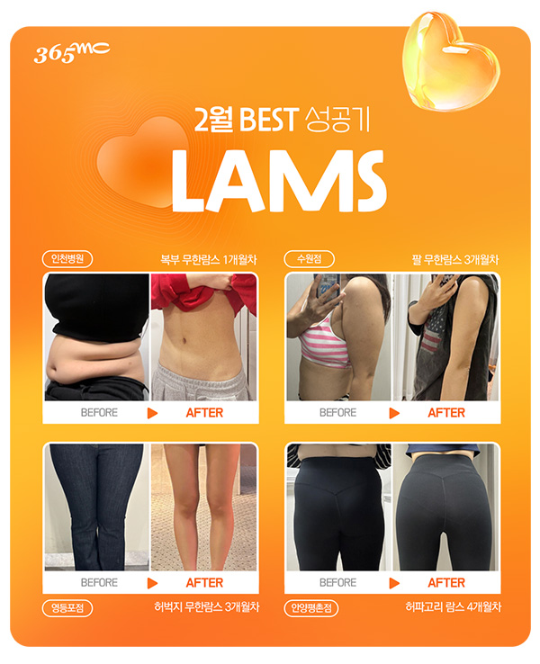 韩国365mc医院2月lams前后对比