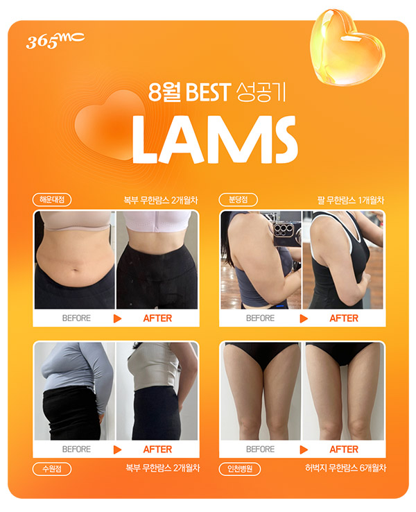 韩国365mc医院lams兰斯吸脂前后对比